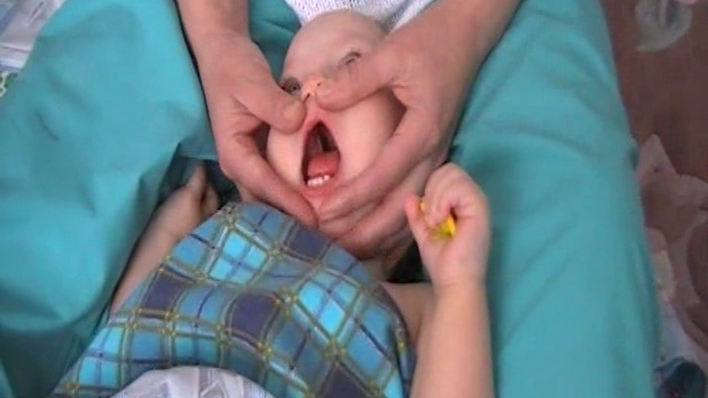 Логопедический массаж