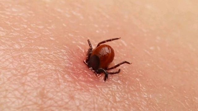 10 укусов насекомых, которые нужно уметь распознавать