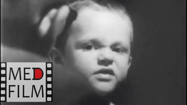 Autism. Child Psychiatry. Behaviour therapy © Аутизм у детей