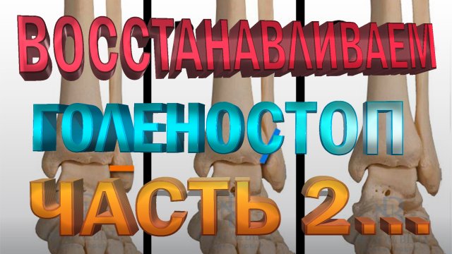 Упражнения для восстановления голеностопа после перелома. Часть 2... Плоскостопие...