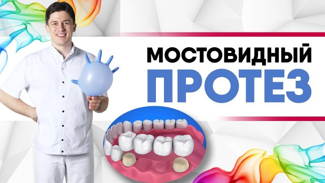 Мостовидные протезы на зубах [ зубной мост, мостовидный протез ]. |Металлокерамика vs цирконий|.