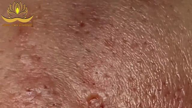 Most Satisfying and Relaxation with An Spa Video #192