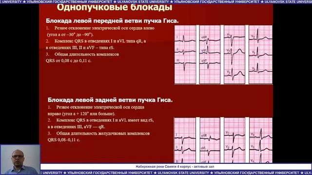 Аритмия