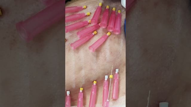 GOLD THREADS |BEAUTICIAN AZIZA | ЗОЛОТЫЕ НИТИ | КОСМЕТОЛОГ АЗИЗА | #beautician #beauty #beautiful