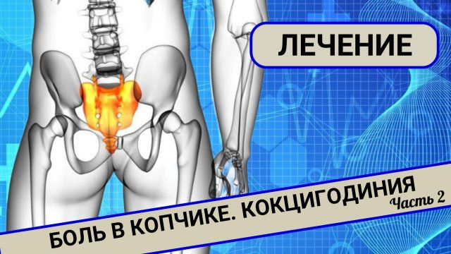 БОЛИТ КОПЧИК. Кокцигодиния. Лечение. (Часть 2)