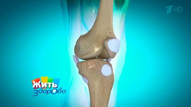 Если боль в колене мешает ходить. Бурсит. Жить здорово! Фрагмент выпуска от 02.11.2015