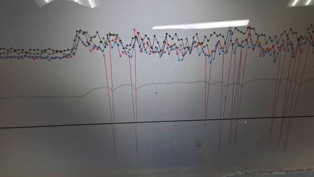 "Дергается вариатор" - ищем причину