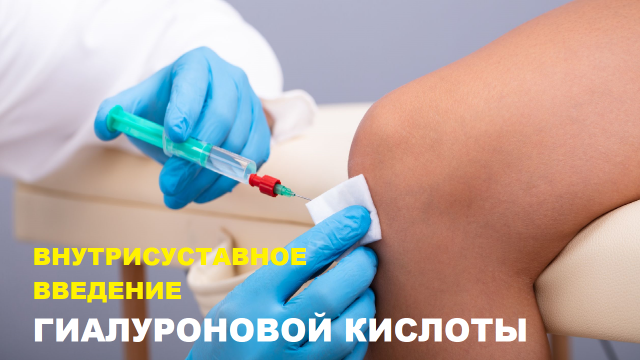Лечение АРТРОЗА коленного сустава ГИАЛУРОНОВОЙ КИСЛОТОЙ