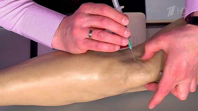 Лучшие средства от боли в суставах. Жить здорово! Фрагмент выпуска от 22.04.2016