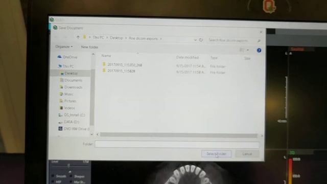 Vatech EZ3dI - How to export DICOM files