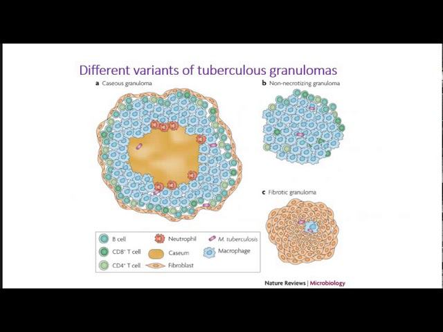 Introduction to tuberculosis course
