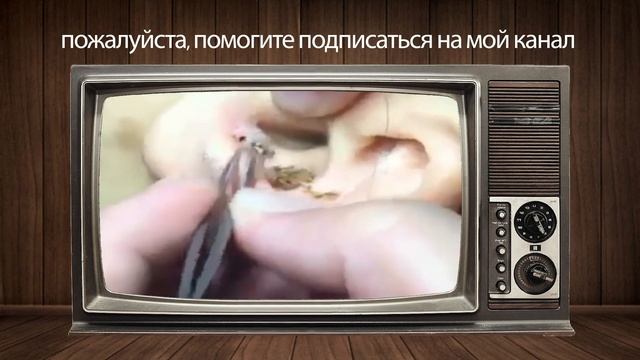 Выдавливание чёрных точек НОВОЕ! Удаление чёрных точек за ухом Чистка лица Прыщи выдавливание01