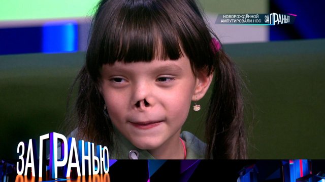 «За гранью»: «Новорожденной ампутировали нос» | Выпуск от 31 августа 2023 года