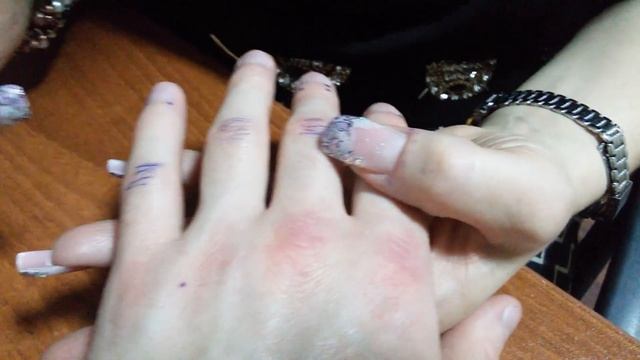 Диагностика тыльной стороны руки "волшебным" прибором Акулайф Tiens-Life Часть 1