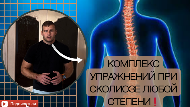 Комплекс упражнений от сколиоза любой степени