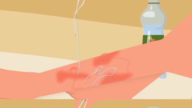 Как Пережить Нападение Диких Животных