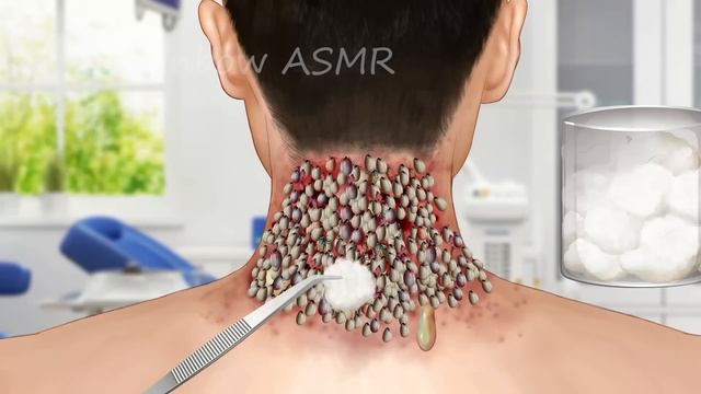 ASMR Dirty Face & Maggot & Worm Removal | Deep Cleaning Animation