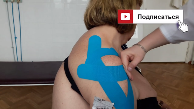 Лечение ПЛЕЧЕВОГО СУСТАВА Тейпирование