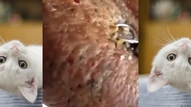 粉刺 粟粒腫 Самое залипательное видео давить прыщи Черные точки Dermatologist video to press pimples