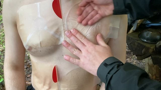 Окклюзионные пластыри. Оригиналы против Китая.