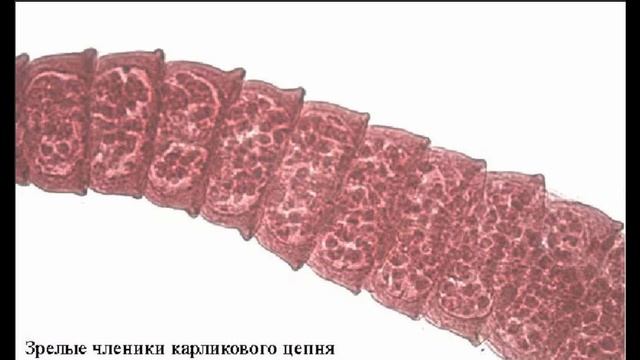 Гименолипедоз - Карликовый Цепень