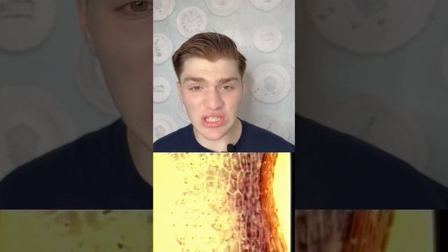 Металл