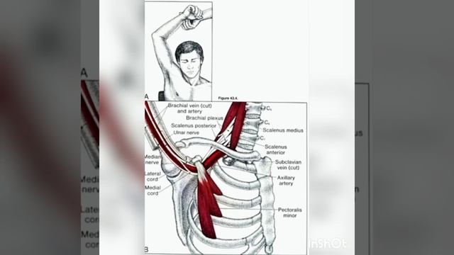 Малая грудная мышца - строение, функция. Синдром малой грудной мышцы