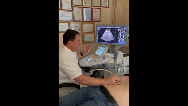 Узи для начинающих. Урок "Эластография печени"