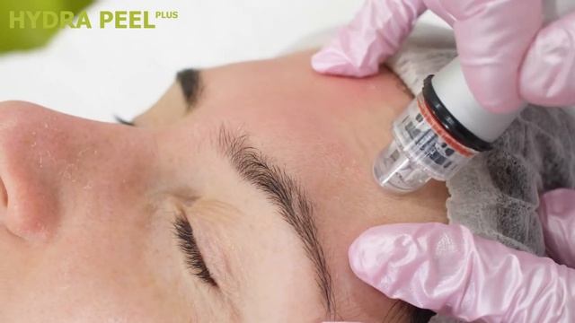 ГИДРОПИЛИНГ HYDRAFACIAL MD – Инновационная методика для очищения и увлажнения кожи