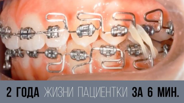 Два года жизни пациентки [всего] за 6 минут‼️