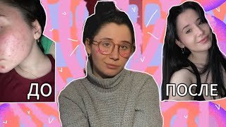МОЙ УХОД ЗА КОЖЕЙ