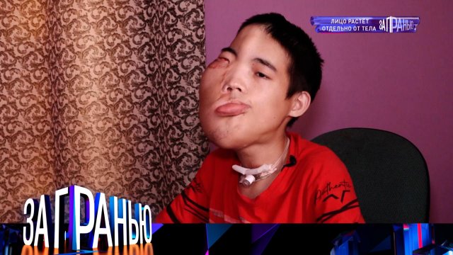 «За гранью»: «Лицо растет отдельно от тела» | Выпуск от 25 августа 2022 года