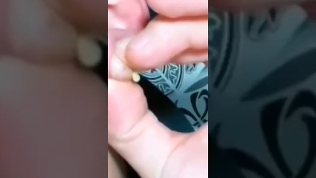 Давить прыщи//Make Your day Relaxing// залипательное видео// чёрные точки выдавливание угри //