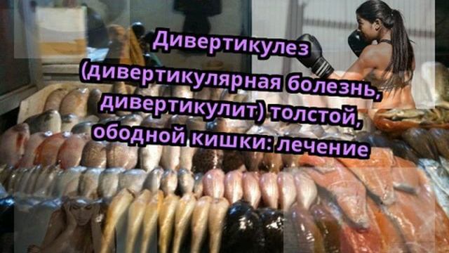 Дивертикулез (дивертикулярная болезнь, дивертикулит) толстой, ободной кишки: лечение