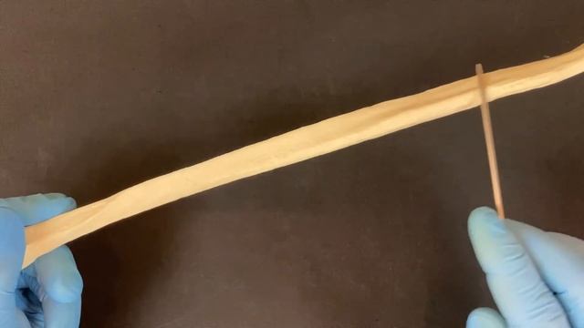 Малоберцовая кость - Fibula (анатомия человека)