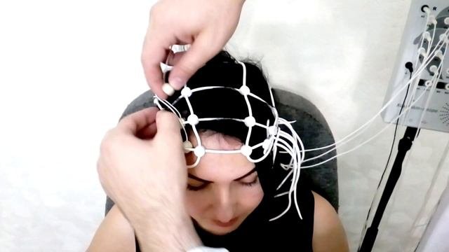 Проведение ЭЭГ с использованием "Компакт-нейро"