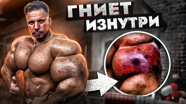 ПОЕХАВШИЕ ЖЕРТВЫ СИНТОЛА! ДИСМОРФИЯ У КАЧКОВ