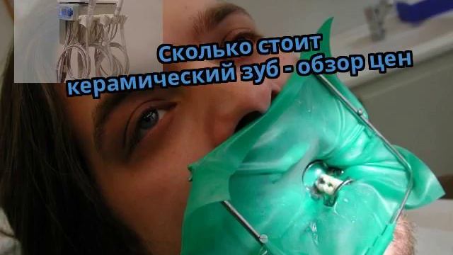 Сколько стоит керамический зуб - обзор цен