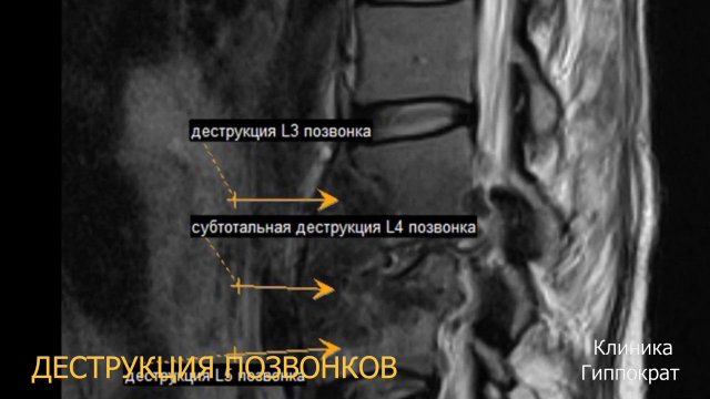 МРТ-диагностика от А до Я. МРТ головного мозга. МРТ позвоночника