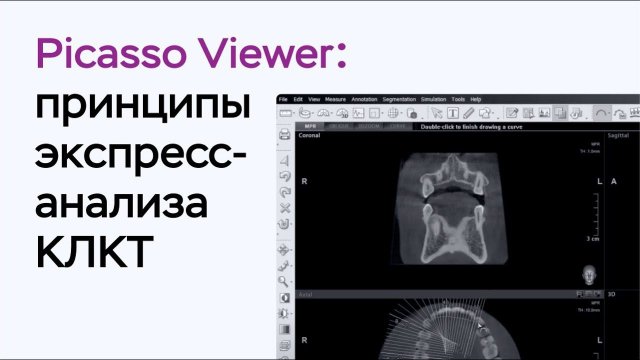 Принципы экспресс-анализа КЛКТ в Picasso Viewer
