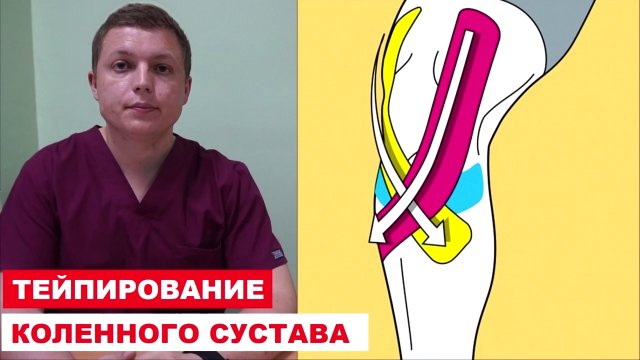 Боль в колене | Тейпирование коленного сустава: особенности применения тейп-лент