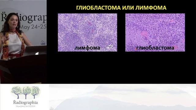 Ирина Трофименко. Когда звонит нейрохирург - подборка случаев