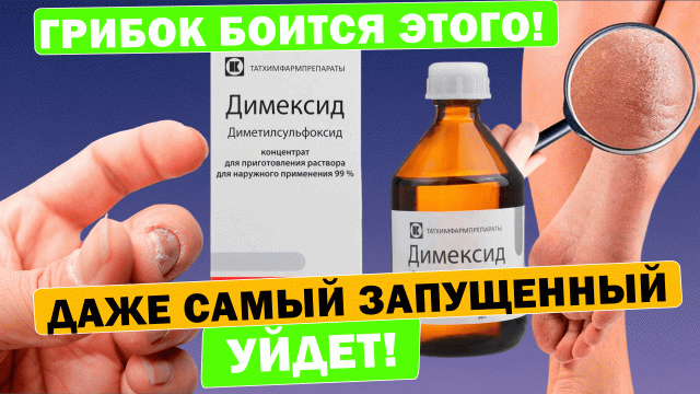 Димексид от грибка спас и ноги вылечил! #димексид