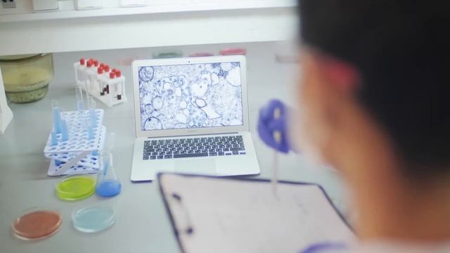 Прыщи на попе: 10 ЭФФЕКТИВНЫХ СПОСОБОВ ИЗБАВИТЬСЯ ОТ ПРОБЛЕМЫ