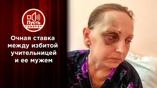 Муж избитой учительницы впервые раскрывает свою правду. Пусть говорят. Выпуск от 20.01.2021
