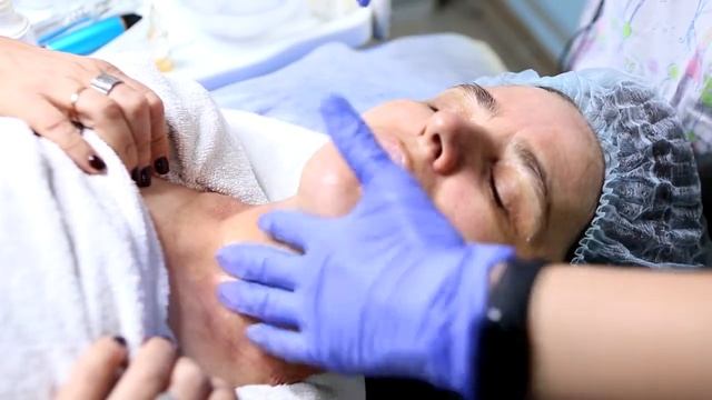 Дермапен / фракционная мезотерапия / микронидлинг (2 часть)