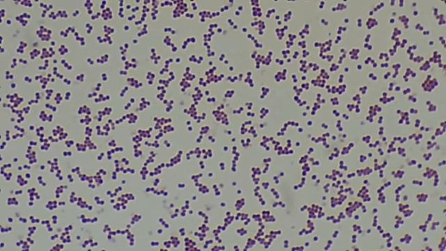 Klebsiella,Staphylococcus,E coli, Candida,Acinetobacter,Bacillus in  Gram stain Under the Microscop