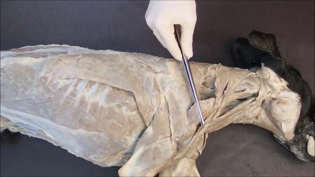 мышцы плечевого пояса