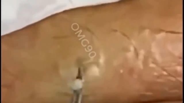 Relax squeezing out blackheads #56 Черные точки