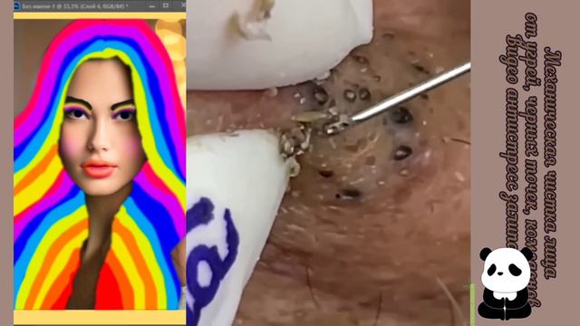 УДАЛЕНИЕ ЧЕРНЫХ ТОЧЕК И УГРЕЙ. АСМР. Релакс. Антистресс.